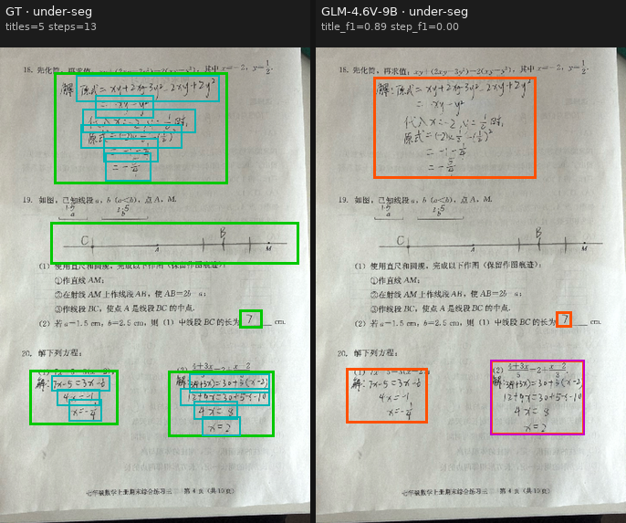 Under-segmentation case